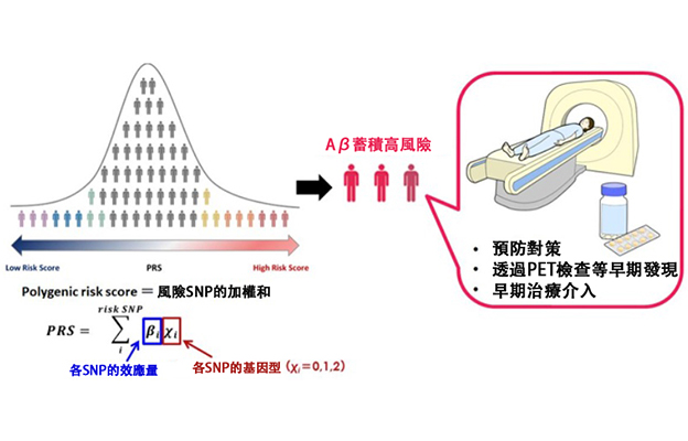 慶應義塾大學醫學部和衛材、實現腦內β-澱粉樣蛋白蓄積風險的可預測，便於掌握阿茲海默症的發病風險
