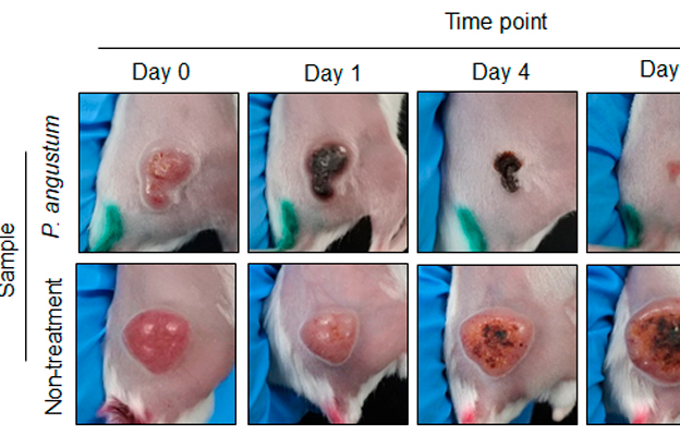 北陸先端科學技術大學院大學發現無需基因改造的海洋細菌可選擇性攻擊大腸癌，治療效果顯著