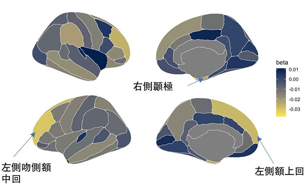福井大學：兒童使用資訊終端的時間與ADHD症狀相關，對大腦構造有影響