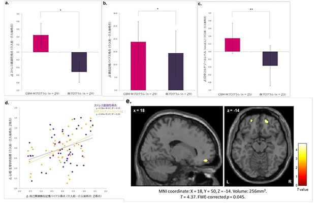 富山大學等研發出記憶干預程序：可緩解大腦反復回憶負面事件的傾向，有望用於壓力相關精神障礙的預防與治療