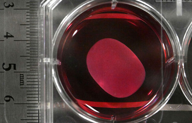 iPS細胞再生醫療產品或3月上旬在日獲批