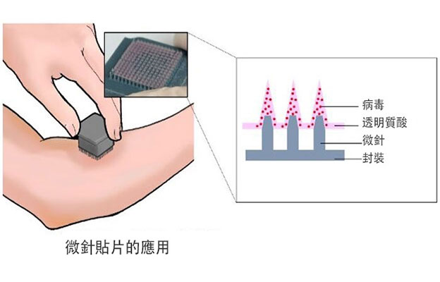 東京大學開發出新冠疫苗微針貼片，旨在實現自我接種和常溫運輸