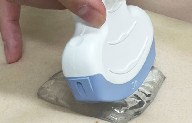 近畿大學開發出超音波檢查用固態凝膠墊，與液體凝膠同效但不黏膩