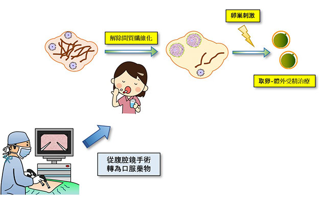 順天堂大學開發出新型不孕症治療方法：口服腎病藥物「非奈利酮」對早發閉經有效