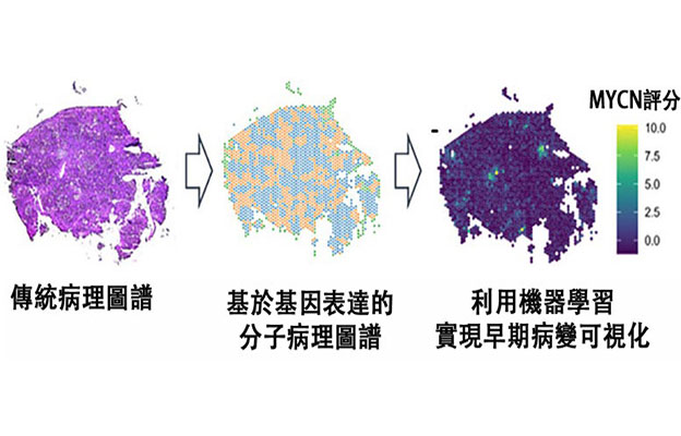 理研等預測肝癌發病風險，MYCN基因表現可作為指標