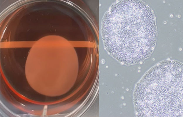 iPS細胞再生醫療產品在日本首次獲批，心力衰竭等疾病的治療選擇將增加