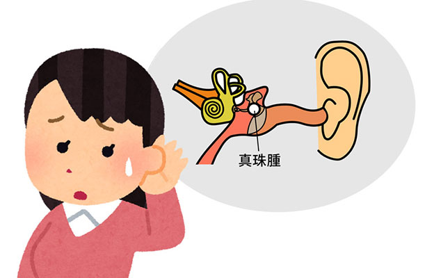 慈惠醫科大學發現治療急性白血病的藥物對難治性慢性中耳炎有效