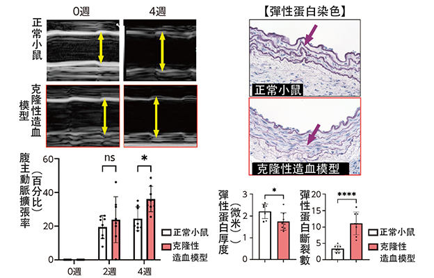 名古屋大學明確老化導致主動脈瘤惡化的機制，為以免疫細胞為靶點的藥物治療策略開闢道路