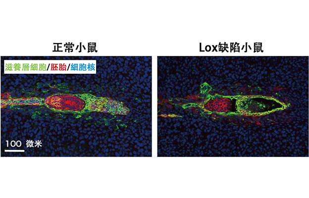 筑波大學學者發現促進胚胎著床後發育與胎盤形成的關鍵酶，為不孕症機制研究與治療思路提供新線索