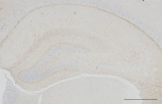 東京大學和新潟大學研發出促進「清潔」大腦的藥物，可抑制阿茲海默症致病因素