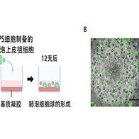 京都大學iPS細胞研究所確定促進I型肺泡上皮細胞分化的訊號通路，有望推動肺部疾病冶癒藥物的開發