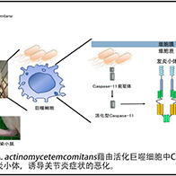 東京醫科齒科大學明確牙周致病菌加劇關節炎的生理機制