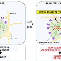 山梨大學等發現導致大腦異常興奮的神經膠質物質，有助於解明癲癇和腦梗等疾病