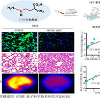 非酒精性脂肪性肝炎視覺化診斷迎來突破性進展：QST團隊開發成功新型[11C]麩醯胺分子探針，助力PET影像無創診斷與療效評估