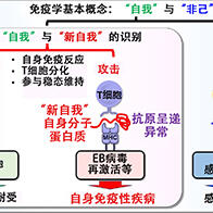 大阪大學成功解明系統性自體免疫性疾病發病機制：T細胞對「自我」與「新自我」的識別能力是致病終極因數