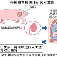 爲了向腎病胎兒移植豬腎，慈惠醫大開始内審