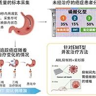 NIBIOHN與國立癌研通過高精度磷酸化信號解析確定胃癌治療靶點，同時明確胃癌在治療過程惡化的情況