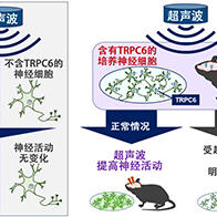 QST等發現用超音波刺激提高腦活動的腦内感測器，有望用於治療神經退行性疾病和抑鬱症