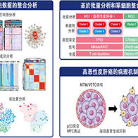 東京科學大學等證實：血管生成抑制劑聯合免疫CP抑制劑對MTM/VECT型肝癌有效，為惡性肝癌治療提供新策略