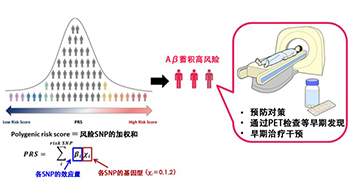 慶應義塾大學醫學部和衛材、實現腦內β-澱粉樣蛋白蓄積風險的可預測，便於掌握阿茲海默症的發病風險