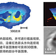 早稻田大學等無損3D成像內耳耳蝸的微結構，利用太赫茲波反射時間觀察形狀進行診斷
