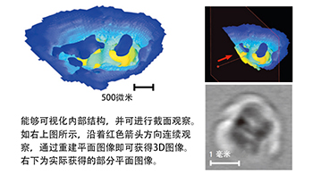早稻田大學等無損3D成像內耳耳蝸的微結構，利用太赫茲波反射時間觀察形狀進行診斷