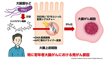 日本國立癌症研究中心：約半數大腸癌或與腸道菌群相關，分泌毒素會引發特定基因突變
