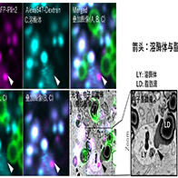 NCNP發現脂肪分解的新機制，有望應用於肥胖、糖尿病的改善以及認知症的預防