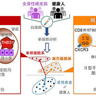 大阪大學發現通過白血球的單細胞分析可預測罕見病「全身性硬皮病」的致命性重症