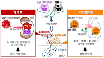 大阪大學發現通過白血球的單細胞分析可預測罕見病「全身性硬皮病」的致命性重症