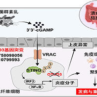 大阪大學闡明潰瘍性結腸炎的發病與重症化機制，OTUD3可調控腸道細菌誘導的發炎反應