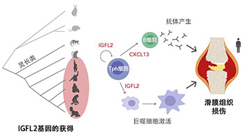 京都大學鑑定出類風濕關節炎中靈長類特異性的新型細胞介素，或為類風濕關節炎治療提供關鍵線索