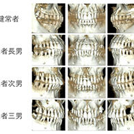 廣島大學明確年輕人群中高發的侵襲性牙周炎致病基因