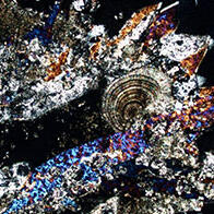 如銀河般璀璨的尿路結石晶體：應用隕石研究方法解讀人體內部環境