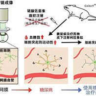 神戶大學實現高分辨率觀察小鼠糖尿病視網膜病灶中免疫細胞的行為