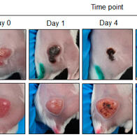 北陸先端科學技術大學院大學發現無需基因改造的海洋細菌可選擇性攻擊大腸癌，治療效果顯著