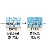 新型水凝膠可預防肝切除術後膽汁漏泄：瞬時凝固止血，長期穩定黏著
