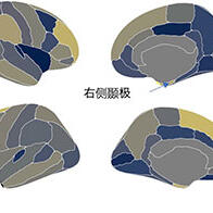福井大學：兒童使用資訊終端的時間與ADHD症狀相關，對大腦構造有影響