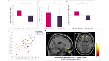 富山大學等研發出記憶干預程序：可緩解大腦反復回憶負面事件的傾向，有望用於壓力相關精神障礙的預防與治療