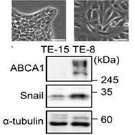 九州大學等闡明脂質代謝失衡會導致抗癌藥難以收效的分子機制 為開拓新治療策略開闢道路
