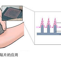 東京大學開發出新冠疫苗微針貼片，旨在實現自我接種和常溫運輸