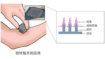 東京大學開發出新冠疫苗微針貼片，旨在實現自我接種和常溫運輸