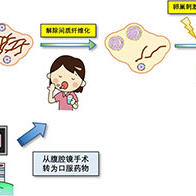 順天堂大學開發出新型不孕症治療方法：口服腎病藥物「非奈利酮」對早發閉經有效