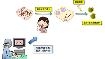 順天堂大學開發出新型不孕症治療方法：口服腎病藥物「非奈利酮」對早發閉經有效