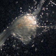 理研等發現生髮的「第三種細胞」，助力脫髮症新型療法