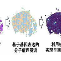 理研等預測肝癌發病風險，MYCN基因表現可作為指標