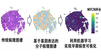 理研等預測肝癌發病風險，MYCN基因表現可作為指標