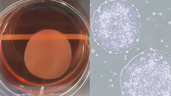 iPS細胞再生醫療產品在日本首次獲批，心力衰竭等疾病的治療選擇將增加