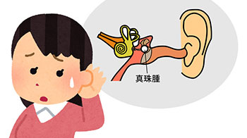 慈惠醫科大學發現治療急性白血病的藥物對難治性慢性中耳炎有效