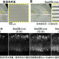 九州大學等實現活體小鼠大腦透明化，在維持正常功能的同時進行螢光觀察